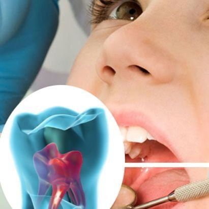 Endodoncia en San Sebastián de los Reyes